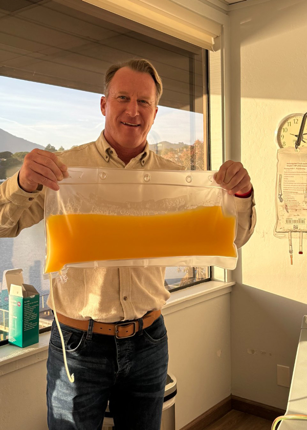 Plasma removed during a single therapeutic plasma exchange session